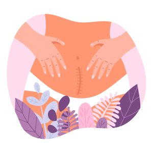 Periods After C-Section