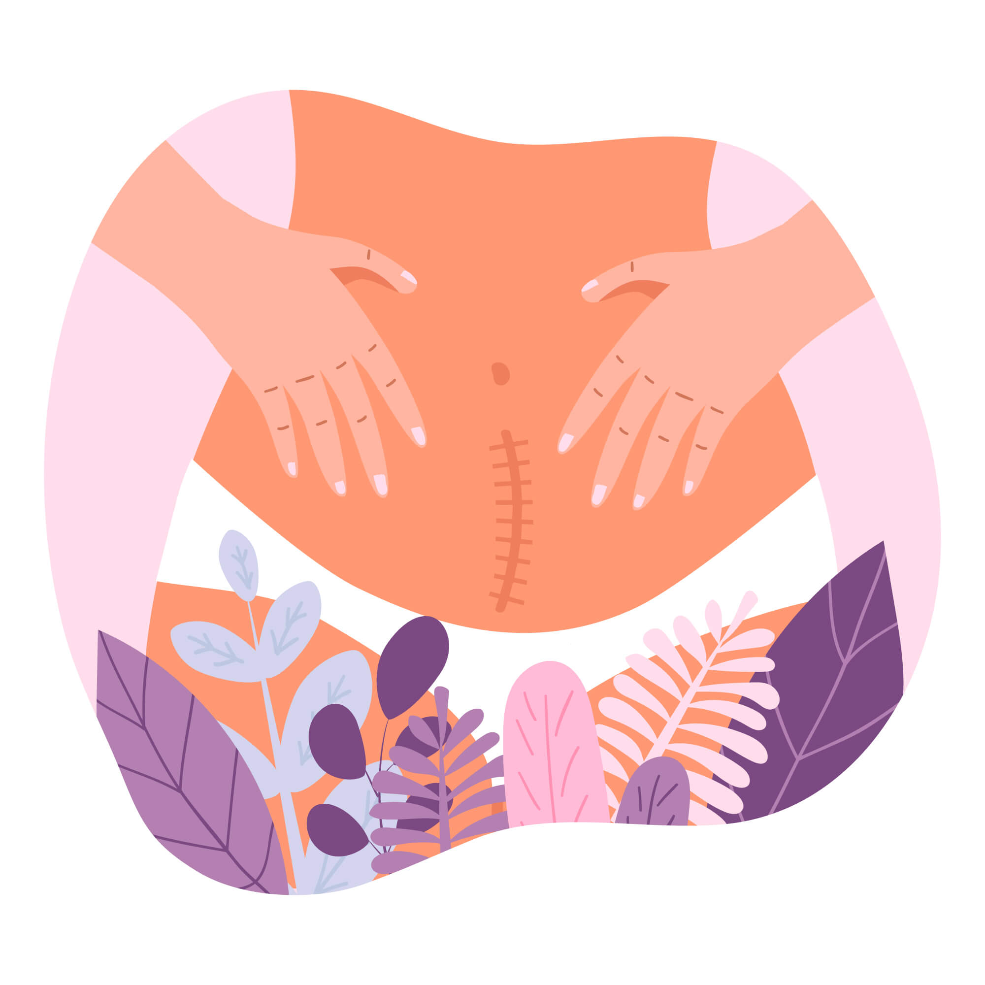 Periods After C-Section